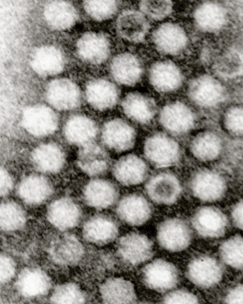 Image: Electron micrograph of adeno-associated viruses (AAVs) (Photo courtesy of Dr. Graham Beards at en.wikipedia).